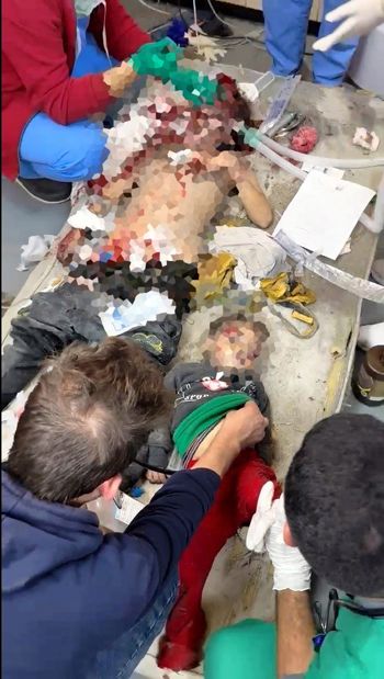 اطفال غزة يموتون بسلاح إسرائيلي محرم دوليا اطفال غزة يموتون بسلاح إسرائيلي محرم دوليا