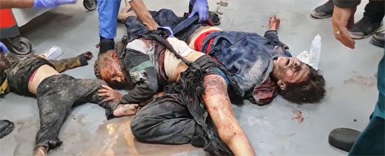 الإجرام الاسرائيلي ضد أطفال غزة الإجرام الاسرائيلي ضد أطفال غزة