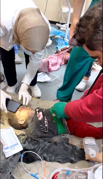 طبيبة تسخدم هاتفها لتوفير إضاءة لفحص طفل في ظل انهيار المستشفيات في غزة طبيبة تسخدم هاتفها لتوفير إضاءة لفحص طفل في ظل انهيار المستشفيات في غزة
