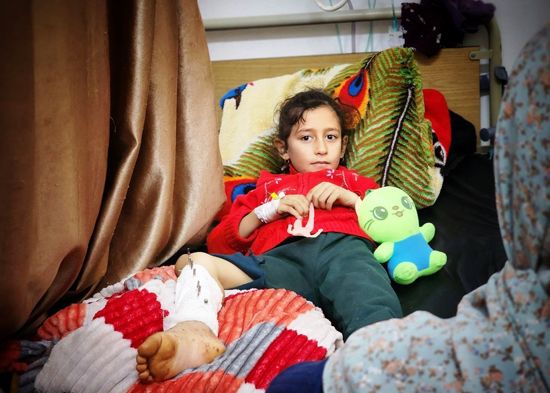 طفل فلسطيني تعرض للحرق طفل فلسطيني تعرض للحرق