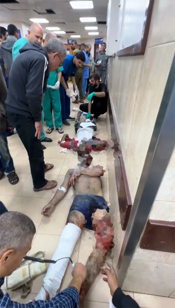 الحروق منتشرة في أجساد أطفال فلسطين بسبب الاسلحة الاسرائيلية المحرمة دوليا الحروق منتشرة في أجساد أطفال فلسطين بسبب الاسلحة الاسرائيلية المحرمة دوليا