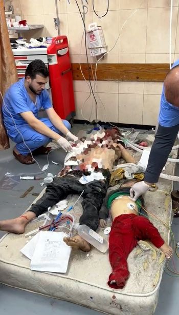 اطفال غزة في مستشفيات القطاع في ظل عجز الاطقم الطبية في نجدتهم اطفال غزة في مستشفيات القطاع في ظل عجز الاطقم الطبية في نجدتهم