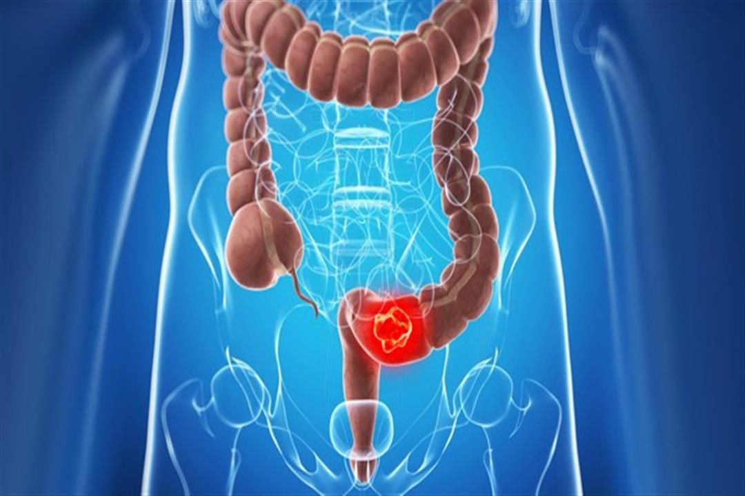 أسباب الإمساك وطرق التعامل معه 