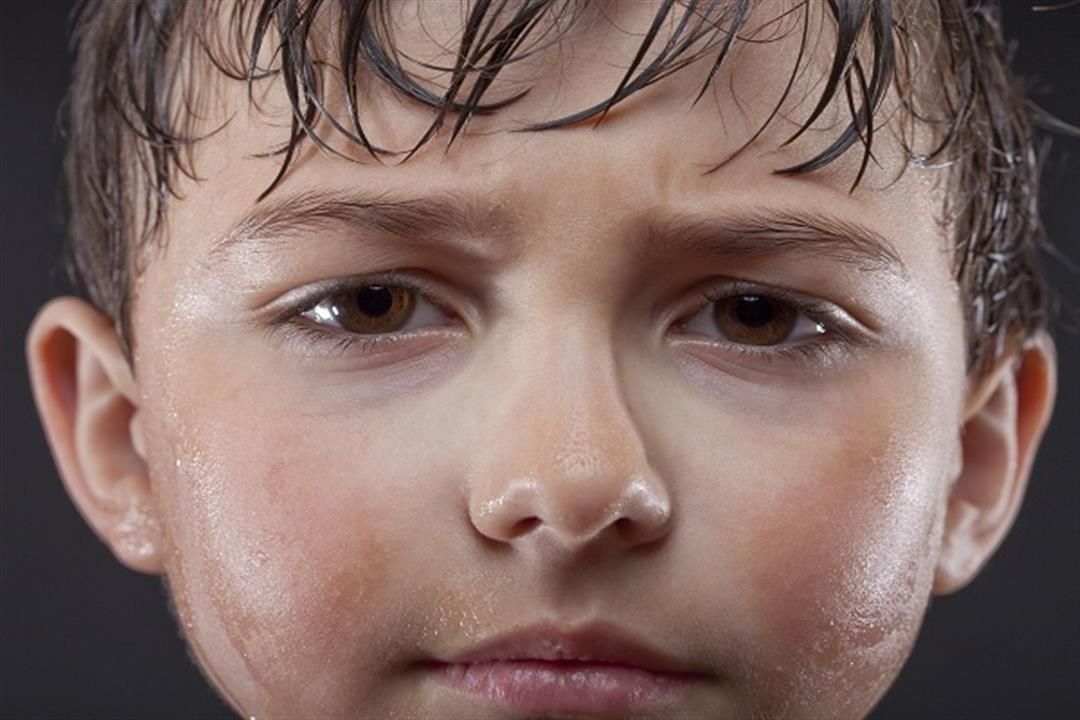 أسباب تعرق الأطفال الغزير من الرأس 