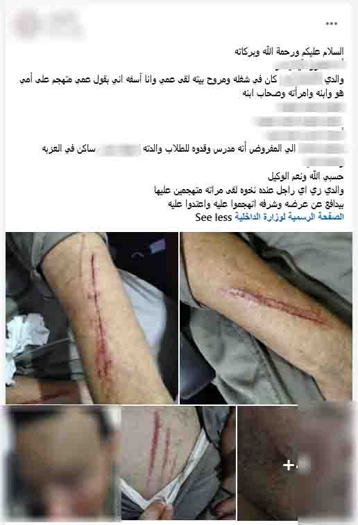 الأمن يكشف ملابسات الاعتداء على عامل بسبب خلافات الميراث في الشرقية ورغبتهم في طرده من المنزل، فيتو