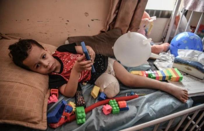غزة تسجّل أعلى معدل لبتر الأطراف لدى الأطفال نسبةً لعدد السكان عالمياً
